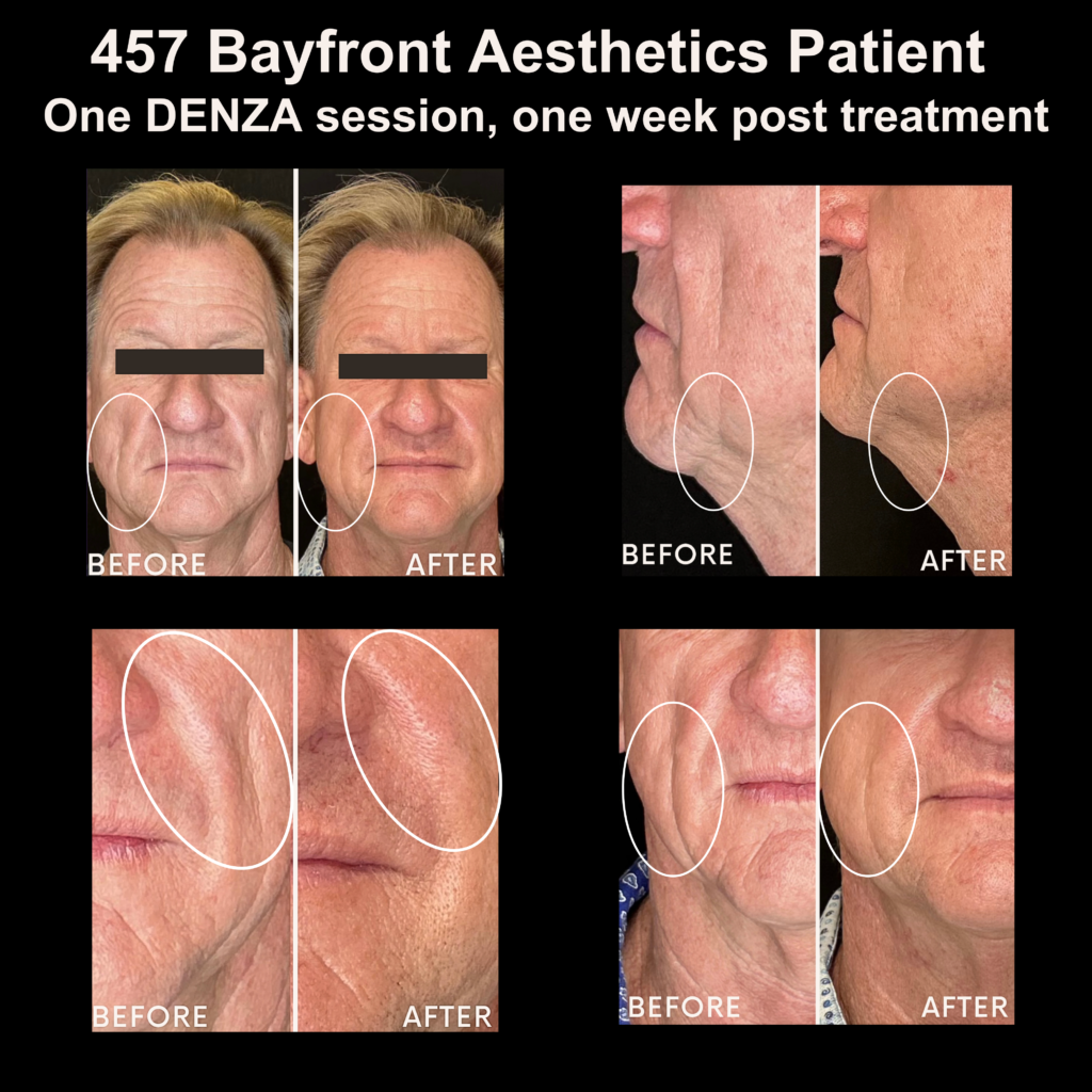 457 Bayfront Aesthetics Patient